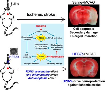 Application of Metal-Based Nanozymes in Inflammatory Disease: A Review